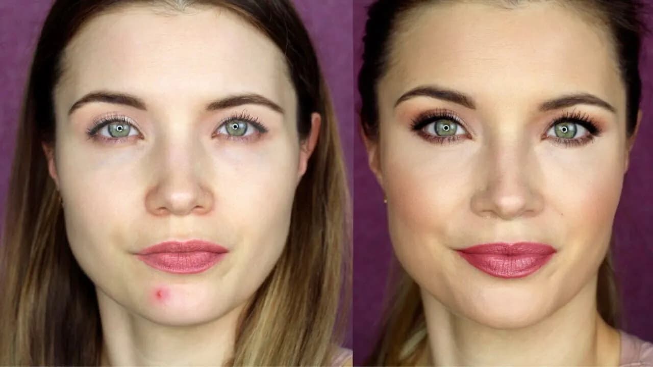 Jak zatuszować pryszcze: skuteczne triki na idealną cerę